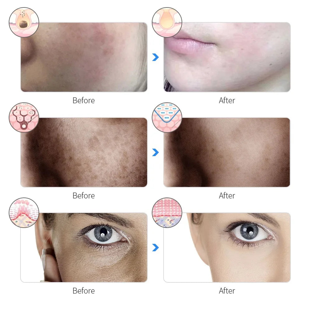 Rechargeable LED Photon Facial Mask - Image 5
